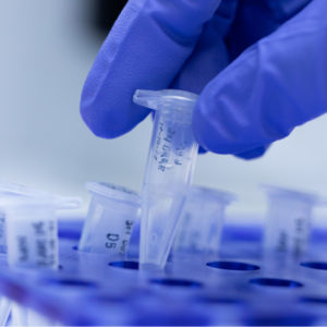 ヒト幹細胞培養液